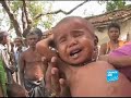 FRANCE24-EN-Report- Malnutrition problems in India