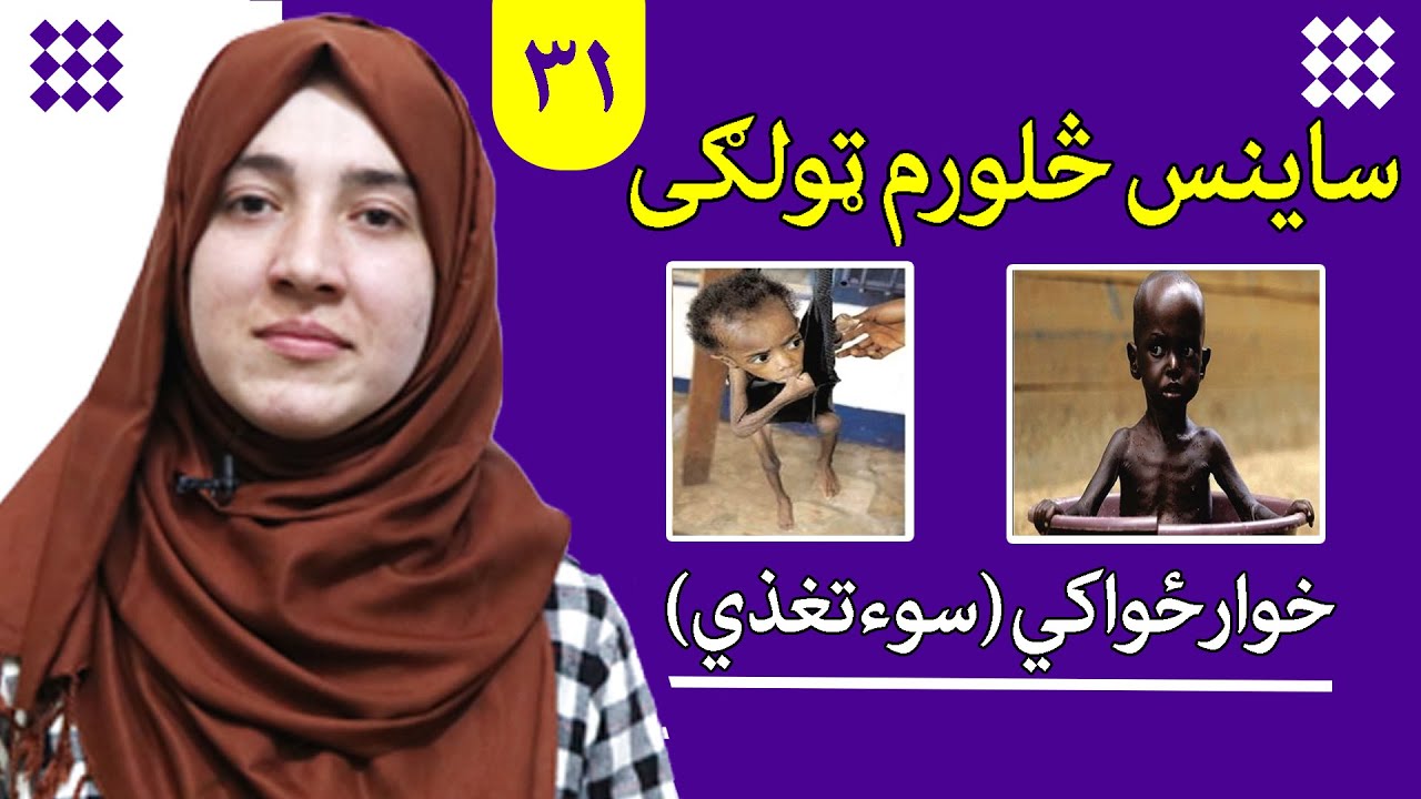 LESSON 31 _ Grade 4 SCIENCE / لوست ۳۱ـ د ساینس مضمون ـ څلورم ټولګی