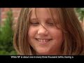 Neurofibromatosis - About The Children\