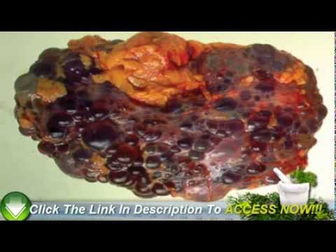 how to assess kidneys