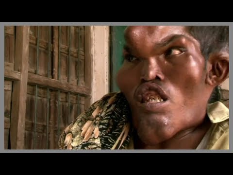 10 Bizarre Medical Anomalies - Top10Stuff
