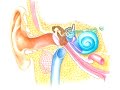 Otitis Media