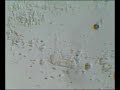 trichodina