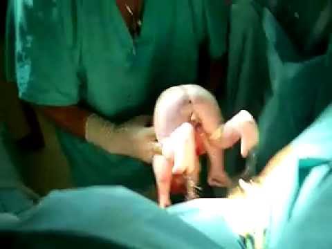 parto natural childbirth l´accouchement birth maternity pregnant maternidad