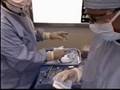 Maxillary Ridge Split Procedure