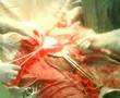 caesarian birth: stitching of uterus