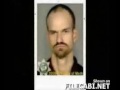 Before and after, The consequence of drugs Before and after, The consequence of drugs
