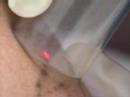 ABC 15 News on Tattoo removal by City of Phoenix ABC 15 News on Tattoo removal by City of Phoenix