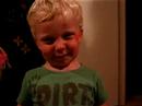 chicken pox