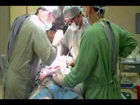 how to get a kidney transplant overseas