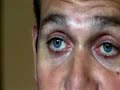 unidad de glaucoma usp instituto oftalmológico de barcelona