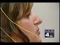 This NBC TV report discusses the use of neurofeedback in the treatment of migraines, highlighting the work of Dr. Deborah Stokes at her center in Alexandria, Virginia.