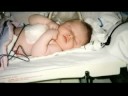 RETINOBLASTOMA_A_FAMILY\ RETINOBLASTOMA_A_FAMILY\