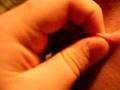 videos de Popping Zombie's Pimple