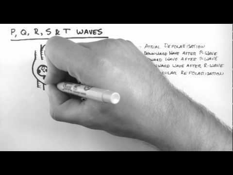how to measure pqrst