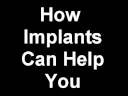 Dental Implants Long Island |Dental Implants Suffolk County Dental Implants Long Island |Dental Implants Suffolk County