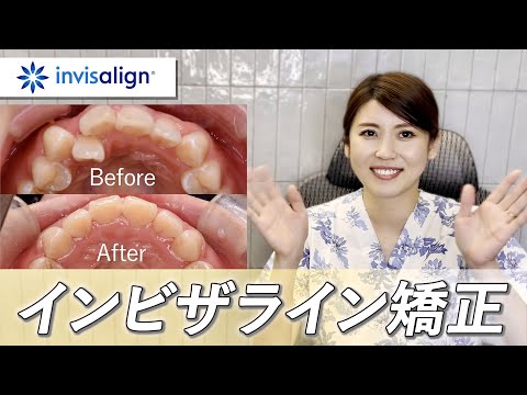 アロハ歯科チャンネル