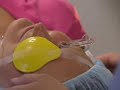 Lasik Surgery