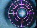 Lasik Surgery Lasik Surgery