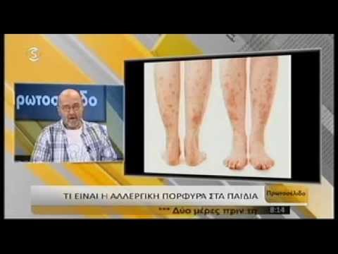 Ιδιοπαθής θρομβοπενική πορφύρα 