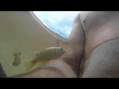 Fish bit my penis Anal hole hurts when pooping