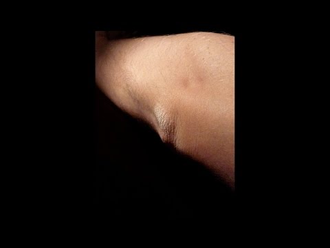 От чего на одном локте кожа шелушится От чего на одном локте кожа шелушится