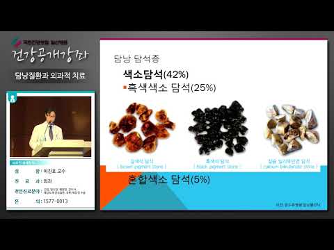 [국민건강보험 일산병원 건강강좌]담낭질환과 외과적 치료