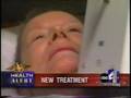 News Feature: Hyperthermia Treatment Recurrent Breast Cancer