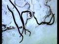 videos de Kent - Gummiband (A Forest Remix)