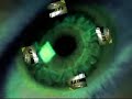 Cam�ra embarqu�e sur mini Z   2eme Volet