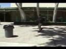 Albinism Video Project