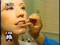 Cosmetic Acupuncture- Known as Face-Lift Acupuncture.