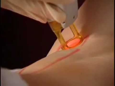 how to dye underarm hair