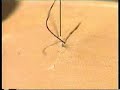 sutura intradermica sutura intradermica