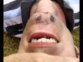 Twinkle Chin