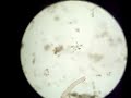protozoa with methyl cellulose bio139_081120