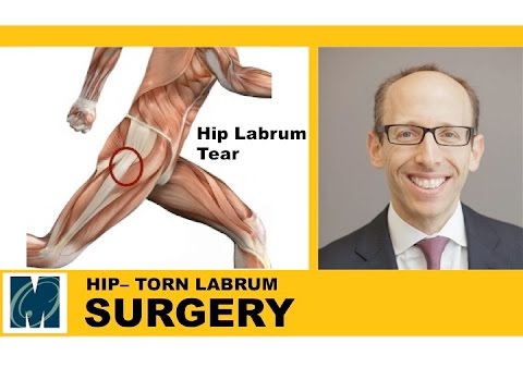 how to relieve labrum tear pain
