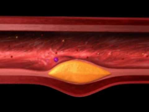 how to control triglycerides level