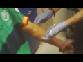 Wheelchair Style - Getting 3 vials of Blood Drawn at Hospital today - L1 injury 8-10-12