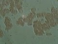 My Live Blood Analysis