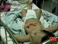 Bebe de 3 brazos