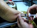Elbow injection viscosupplementation ????????? ?????????