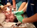 birth