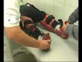 ORTEZ, spina bifida, Ferrari ortezi, uzun y�r�me cihaz?
