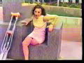 amputee dusty 2