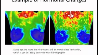 What is Medical Thermography?