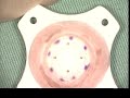 Iris-Sutured Intraocular Lens Implantation and DSAEK