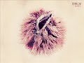 Emarosa-What\