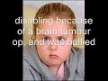 disabilities disabilities