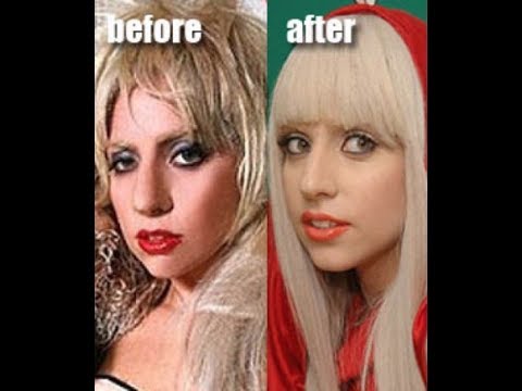 ESTRELLAS DE HOLLYWOOD ANTES Y DESPUES DE LA CIRUGIA PLASTICA